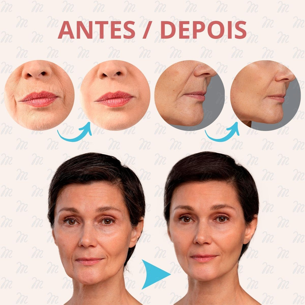 Adesivos Anti Rugas para Rosto Modelo:1 Peça (Testa)